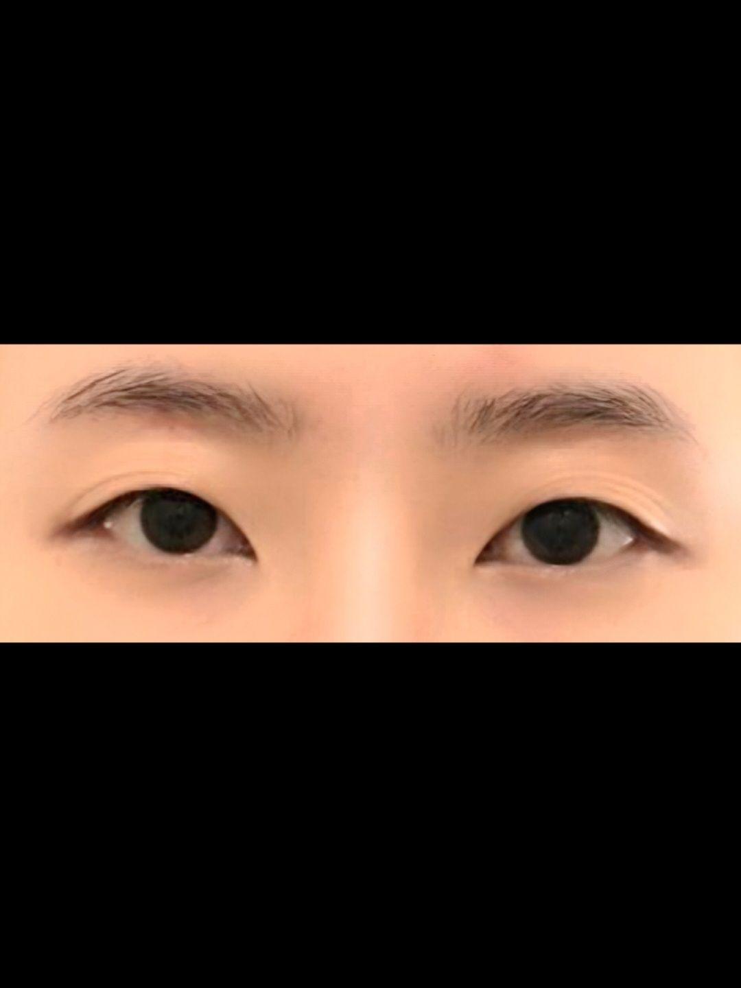 後