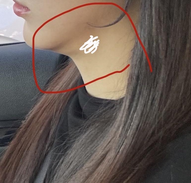 前