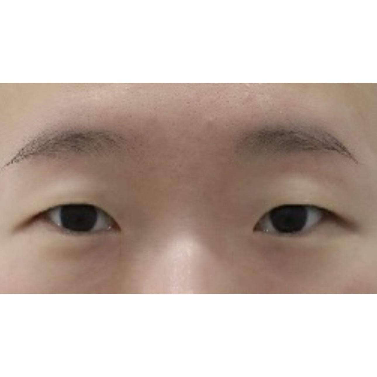 後