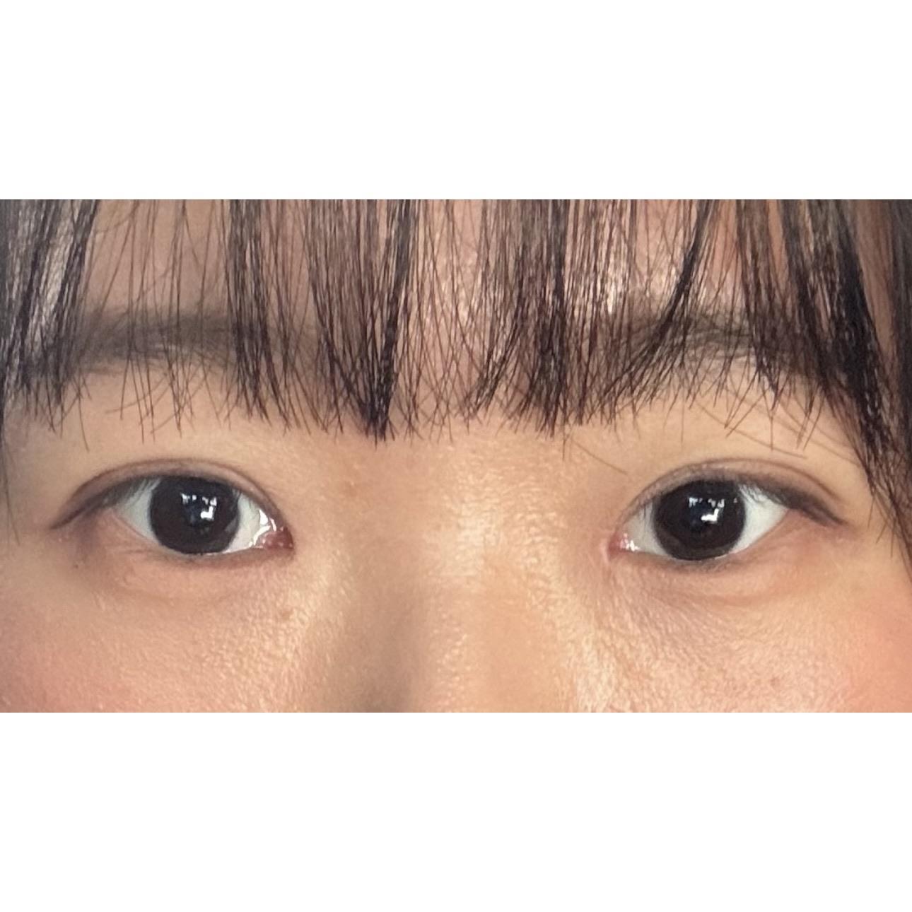 後