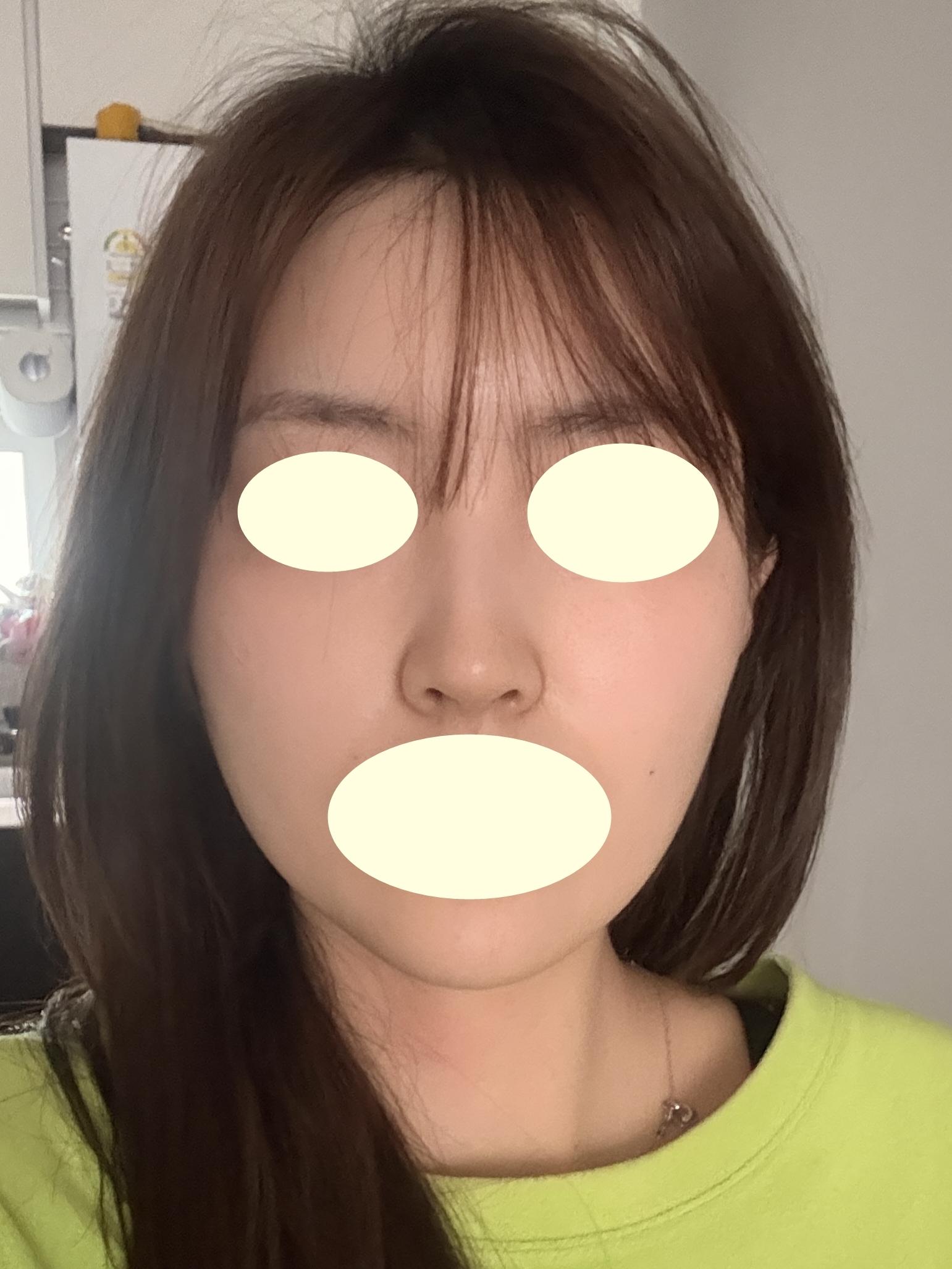 後