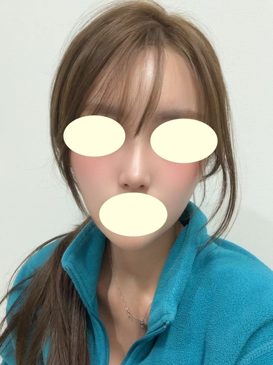 後