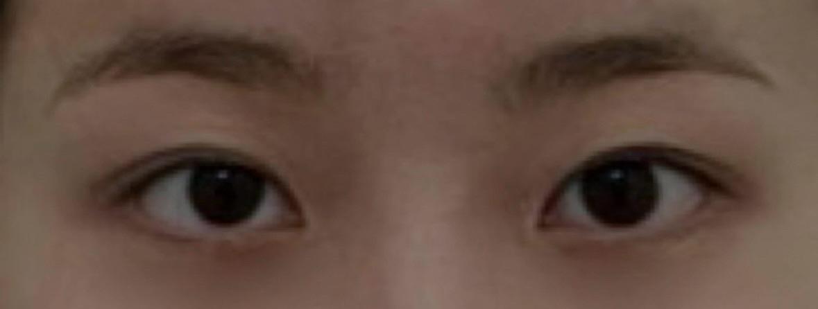 後
