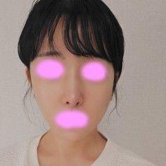 後