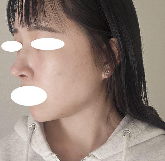 後