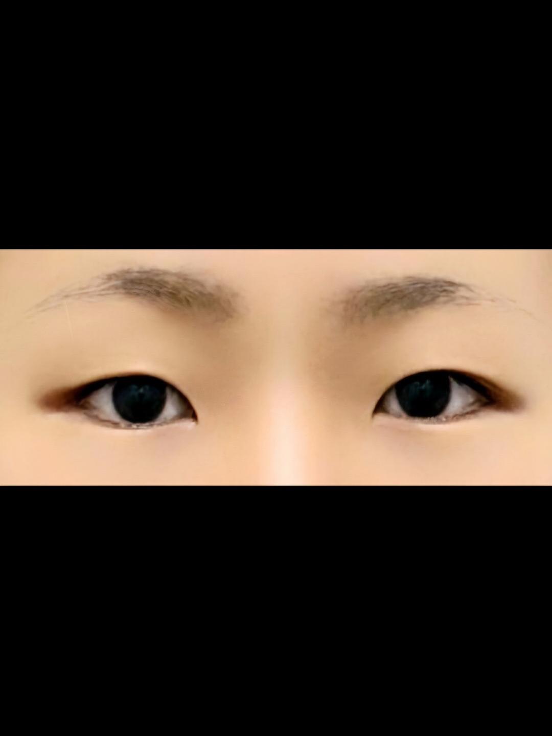 後