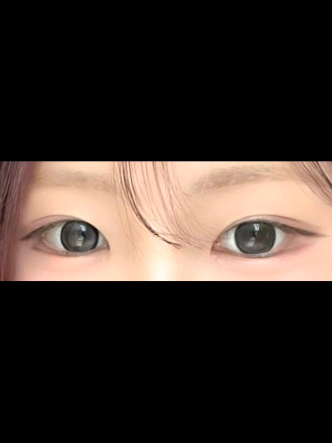 後