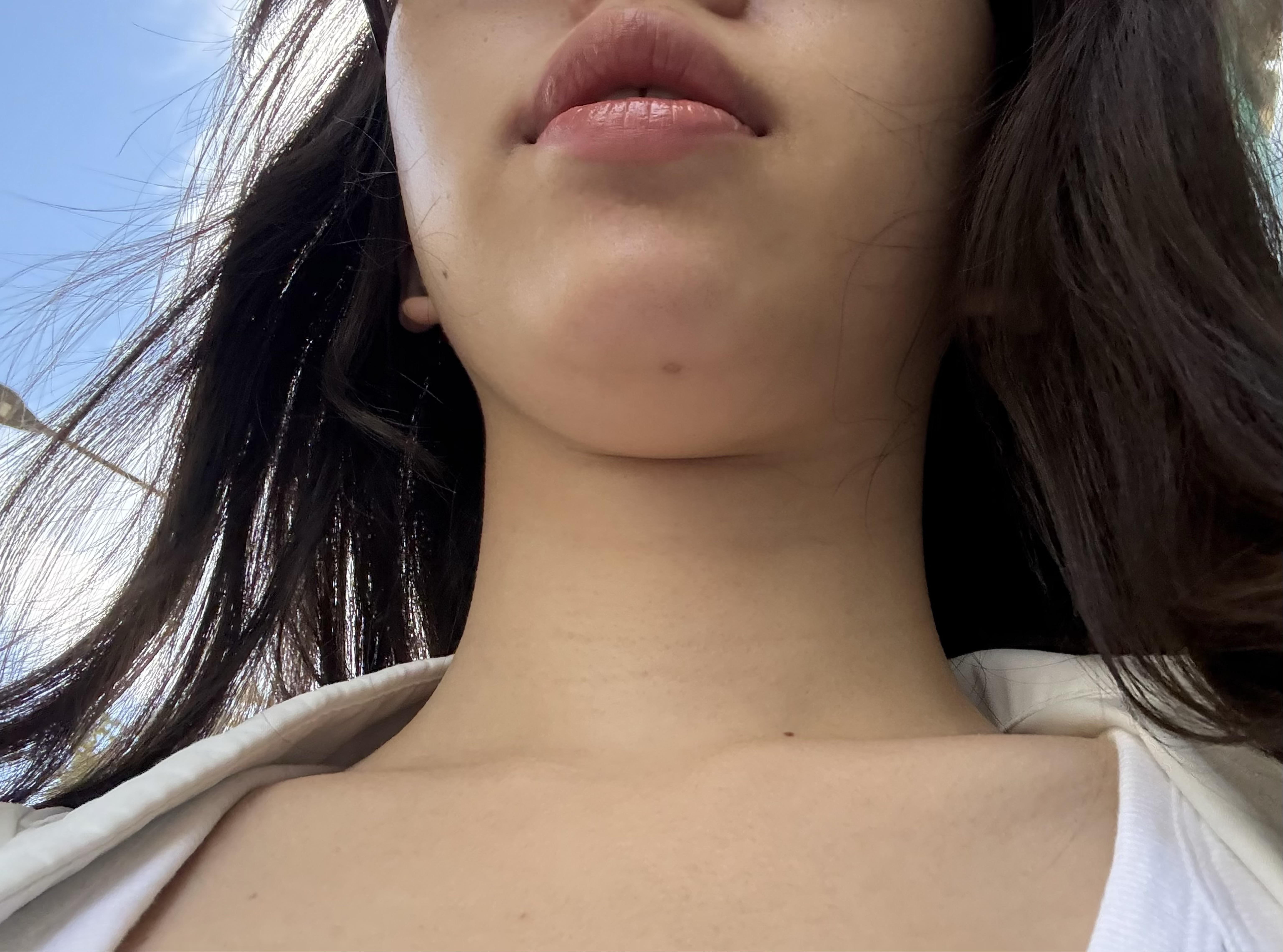 後