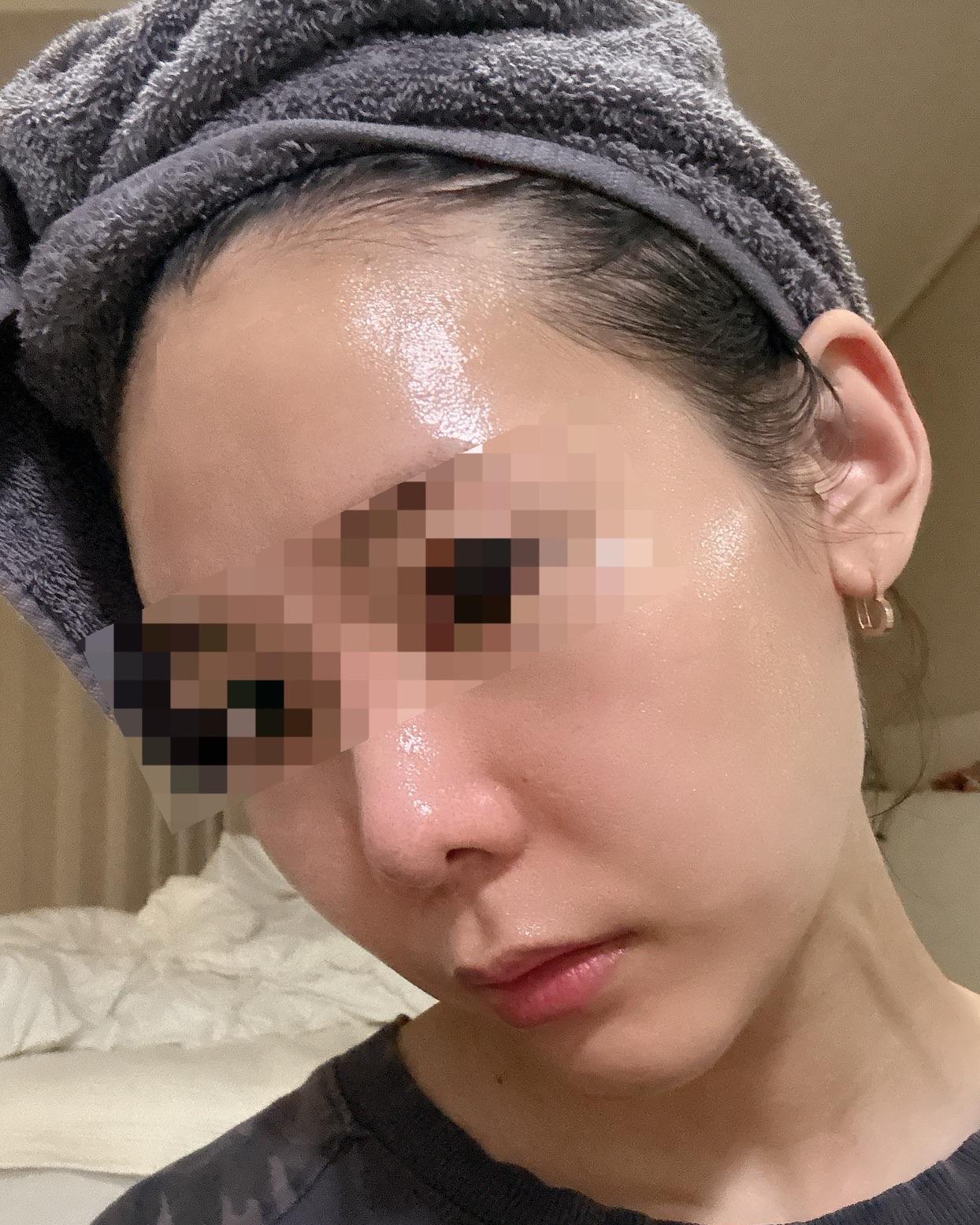 後