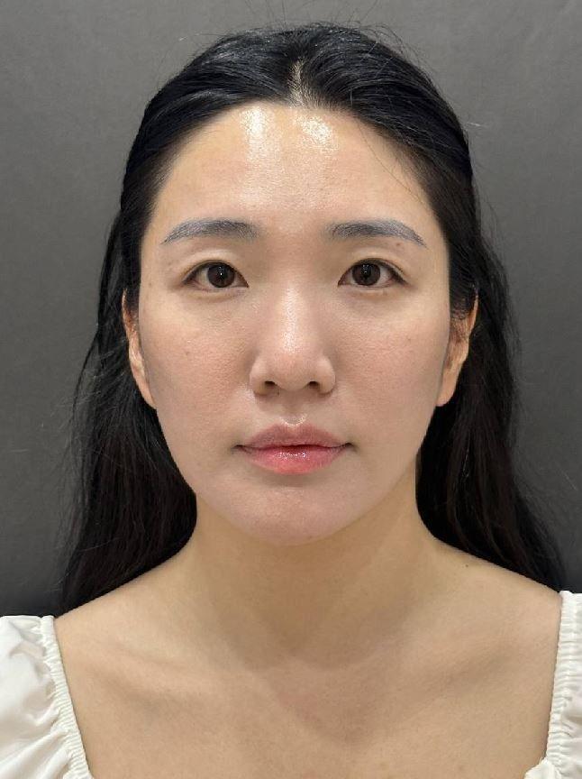 後