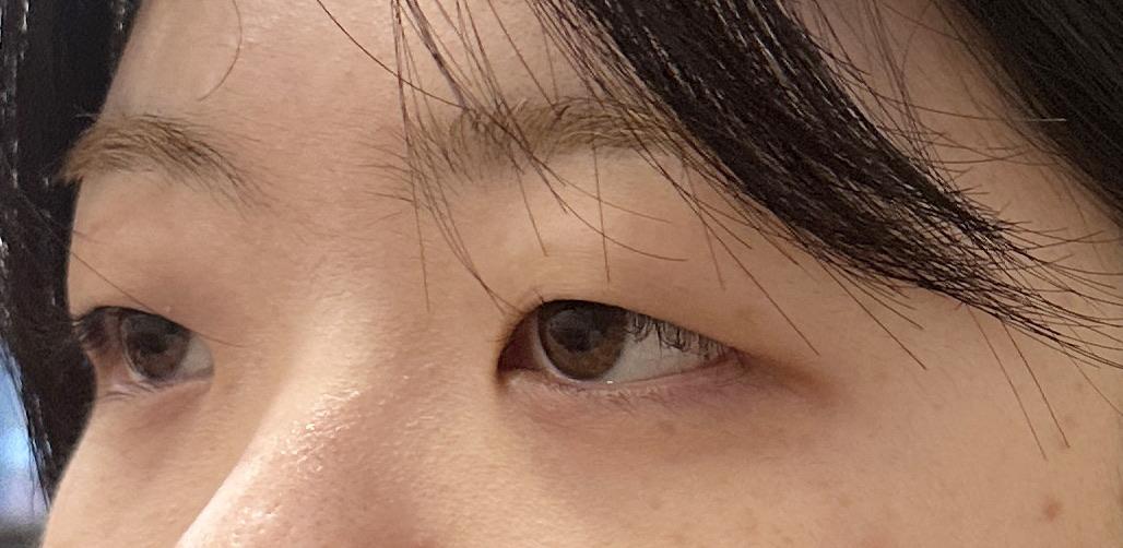 前