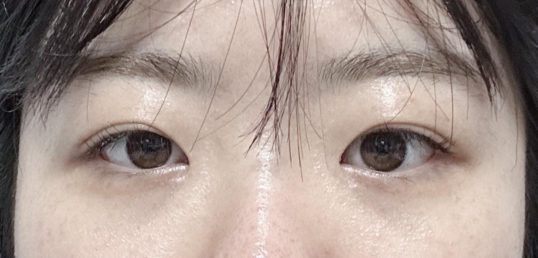 后