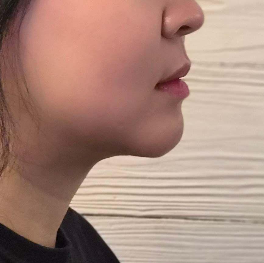 後