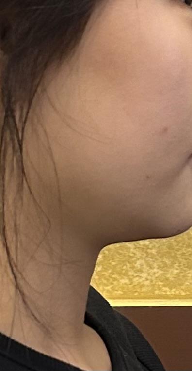 後
