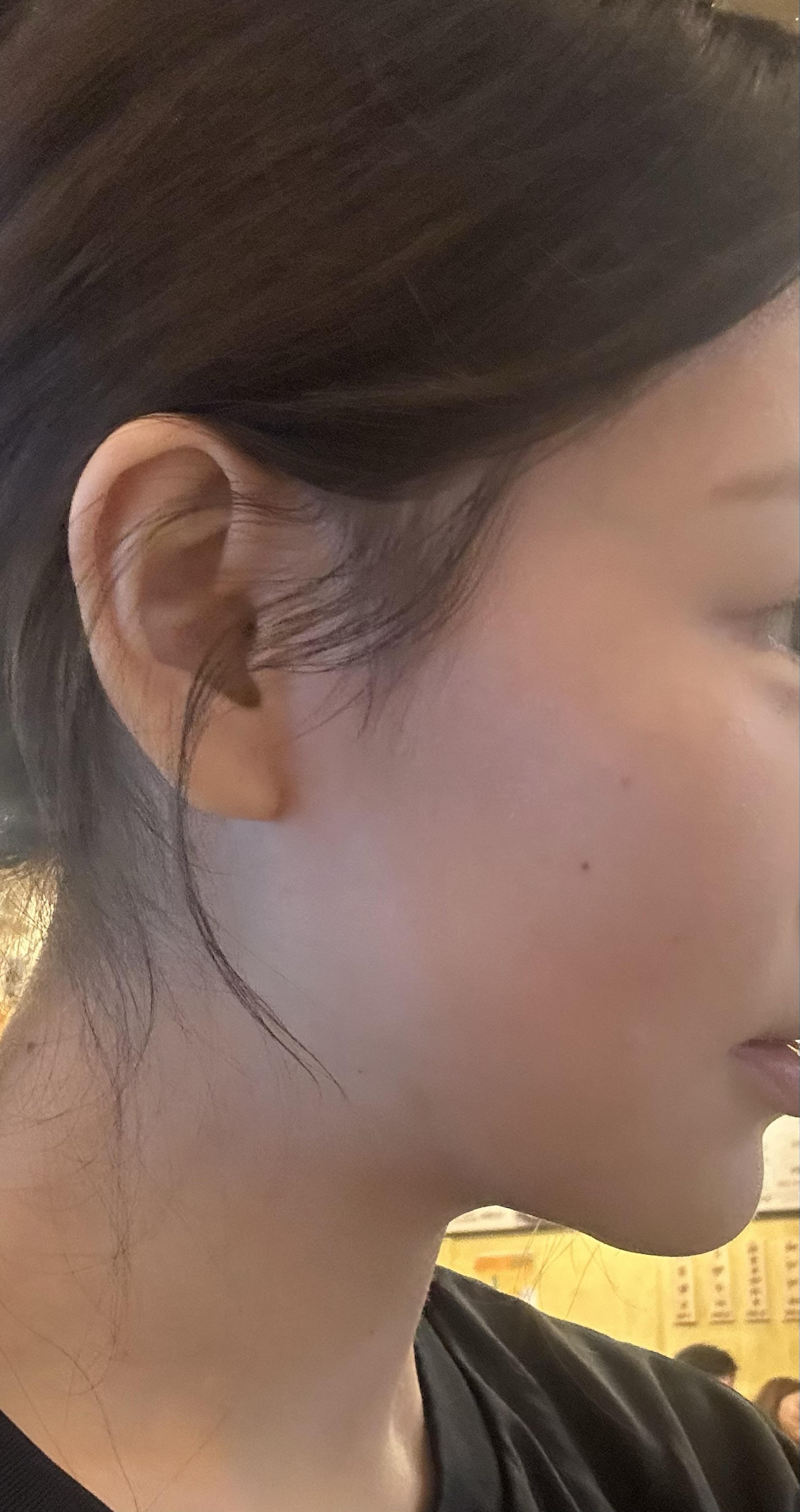 後