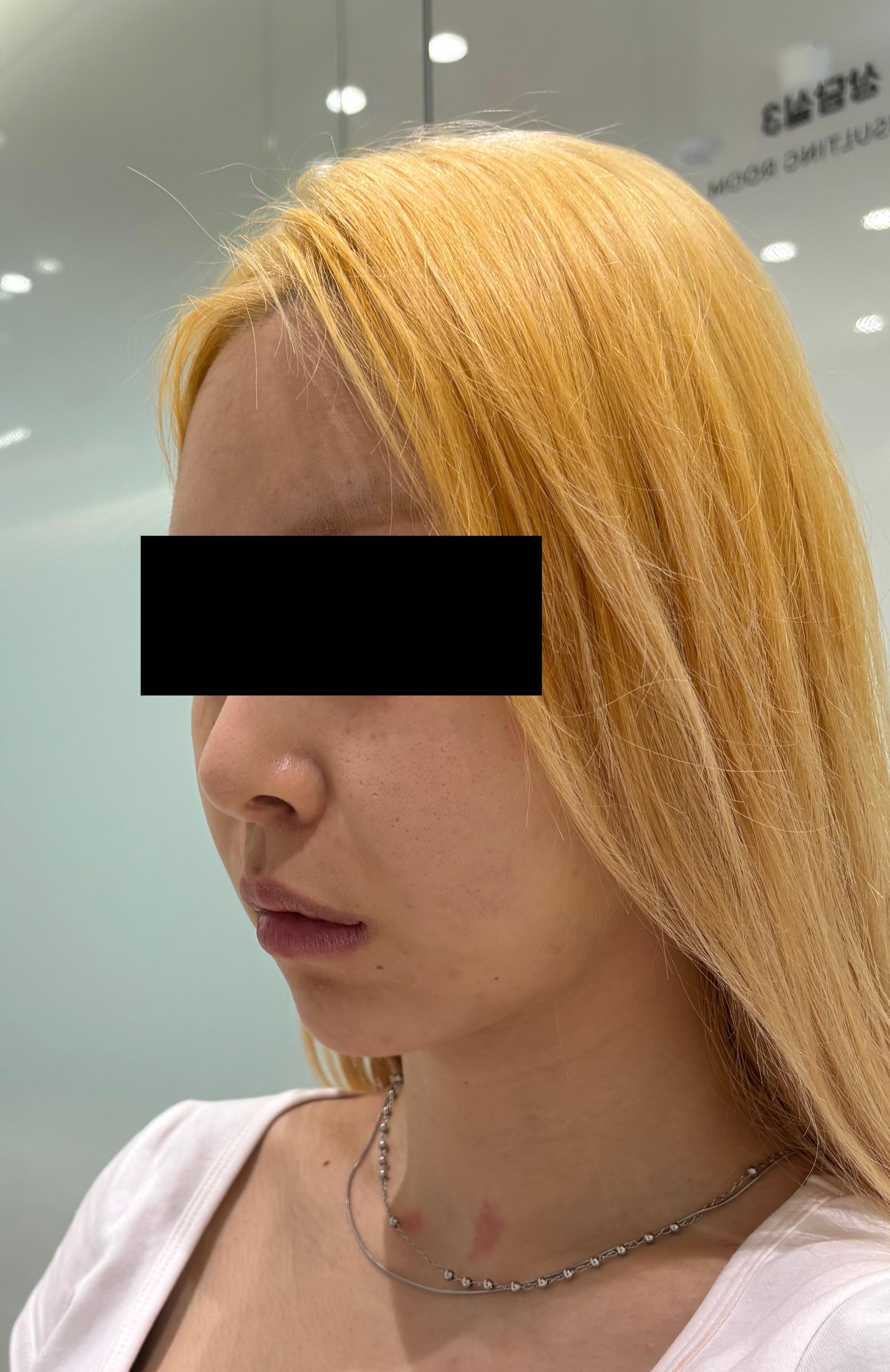 Before