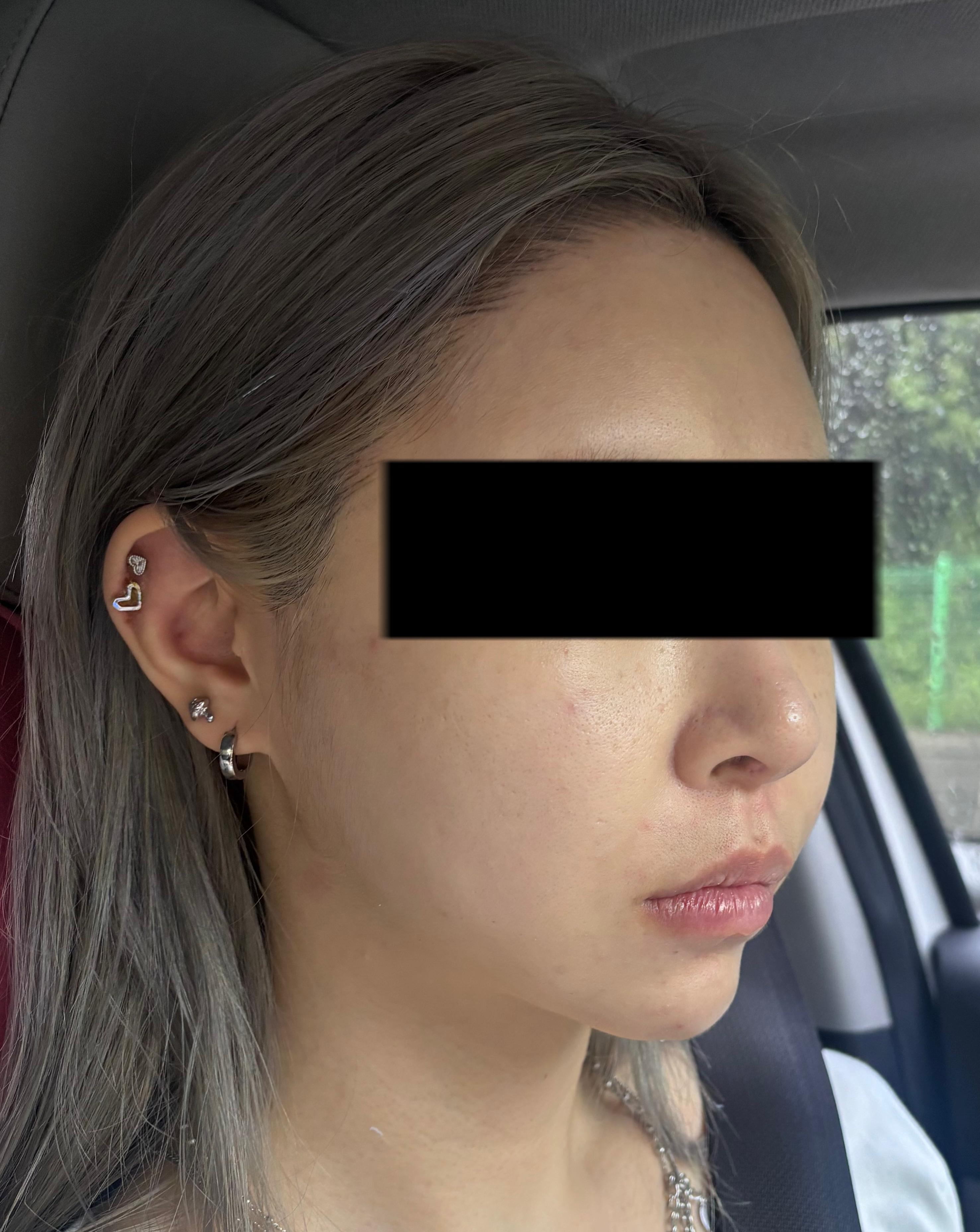 After