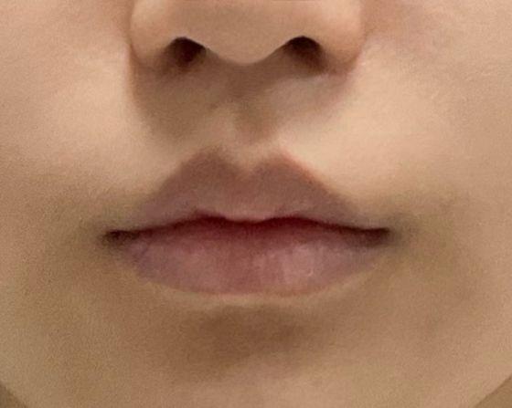 後