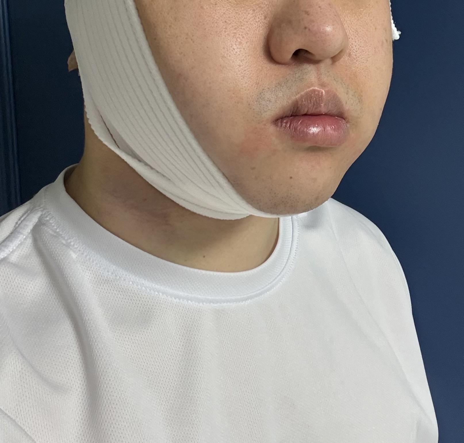 後