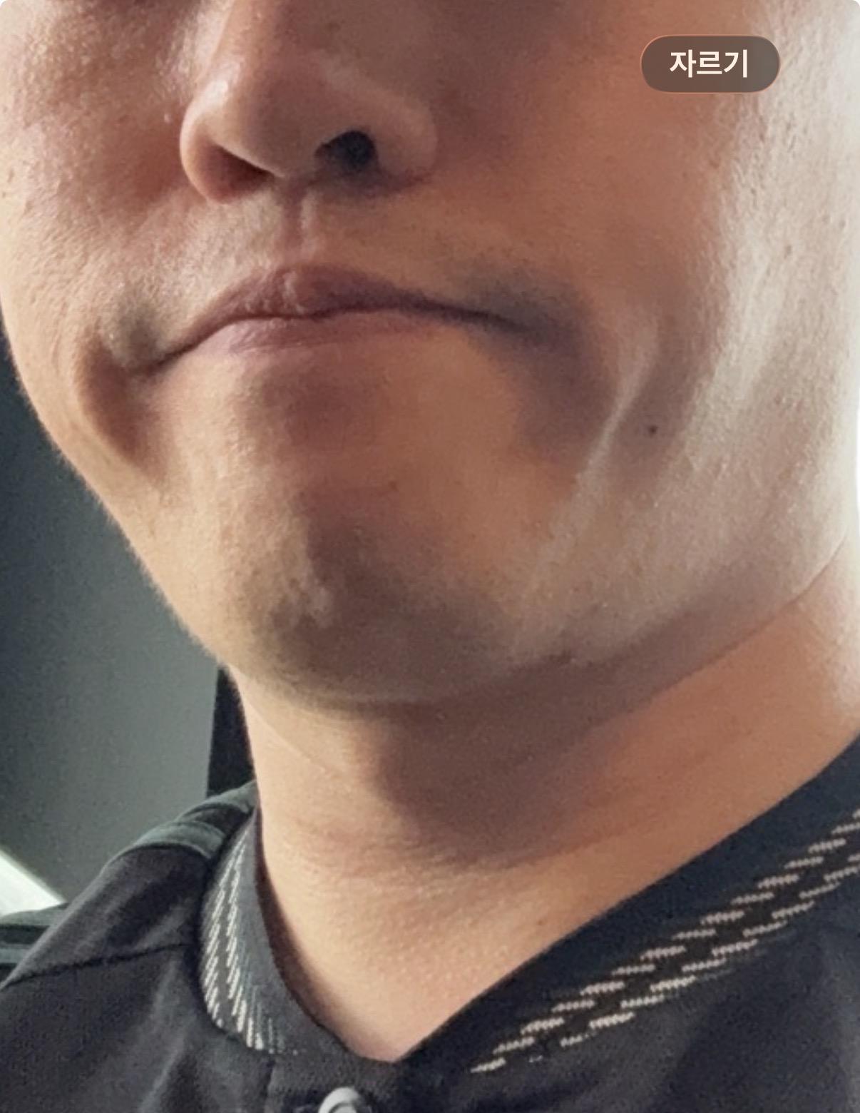 後