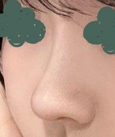 後