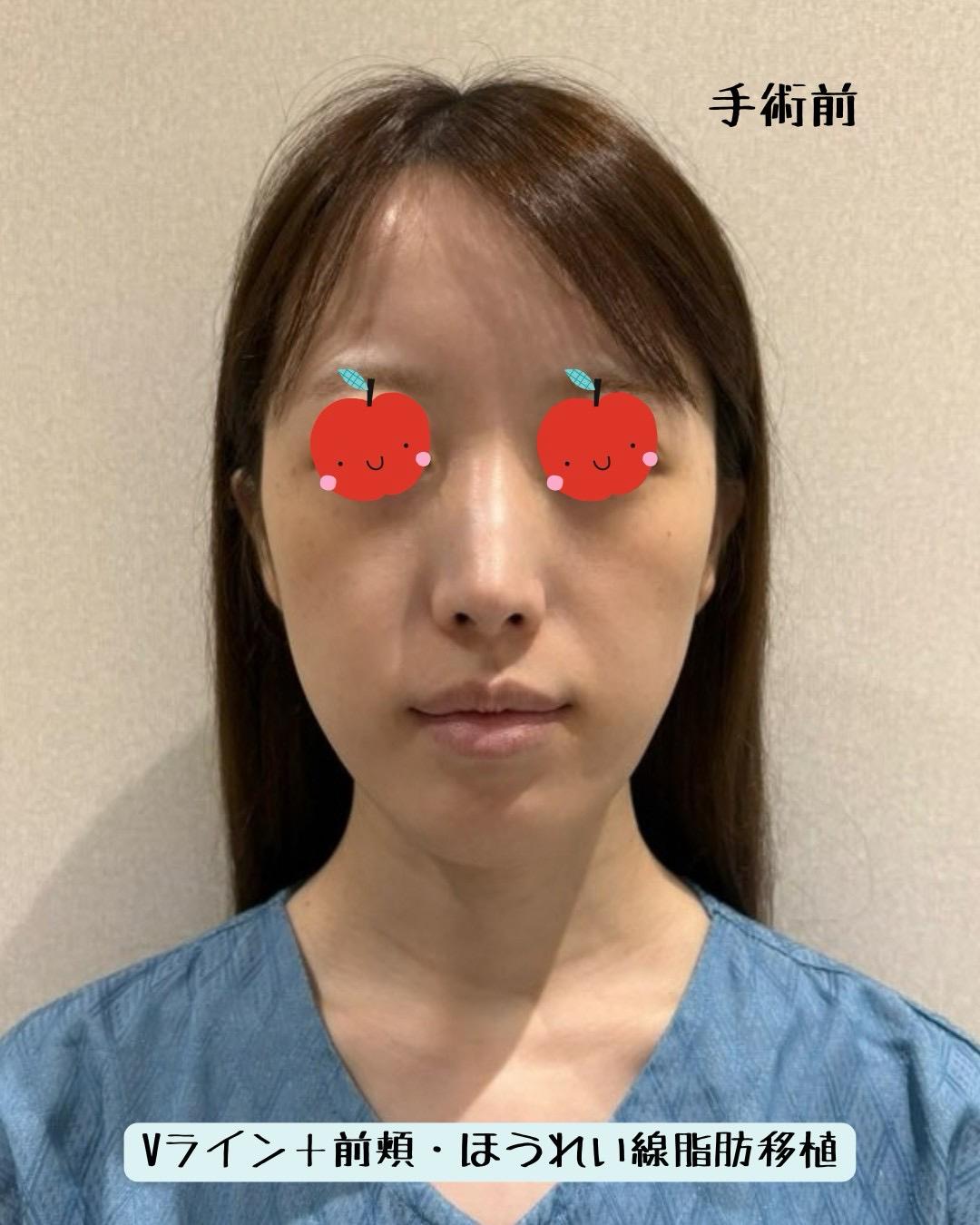 後