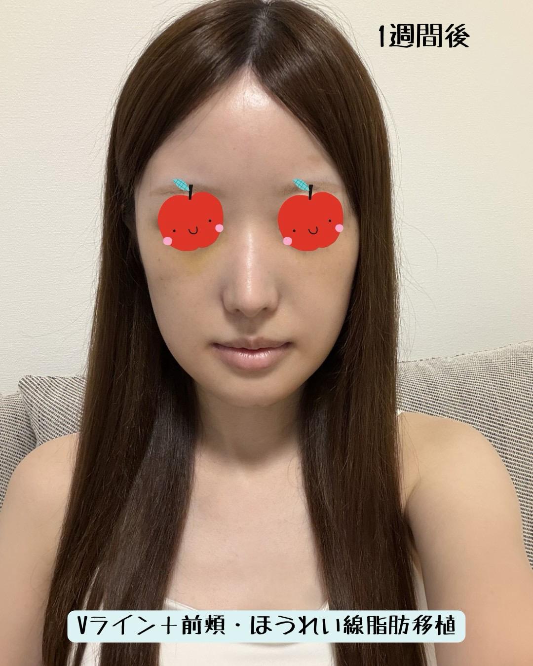 後