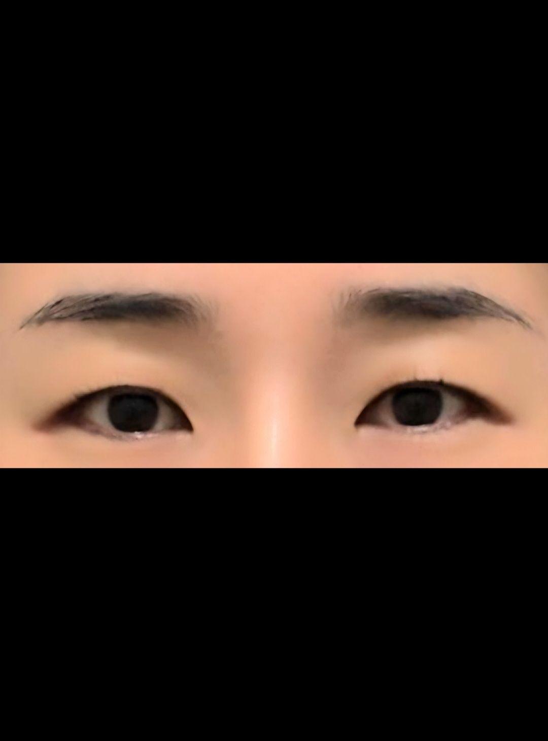 後