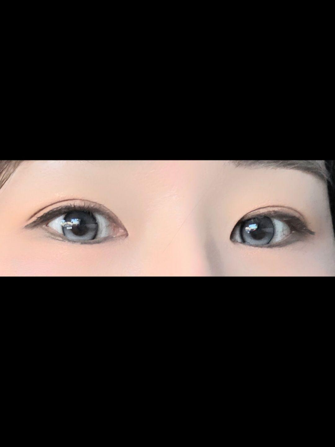 後