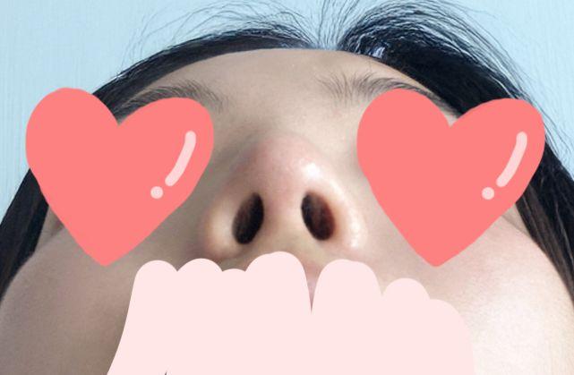 後