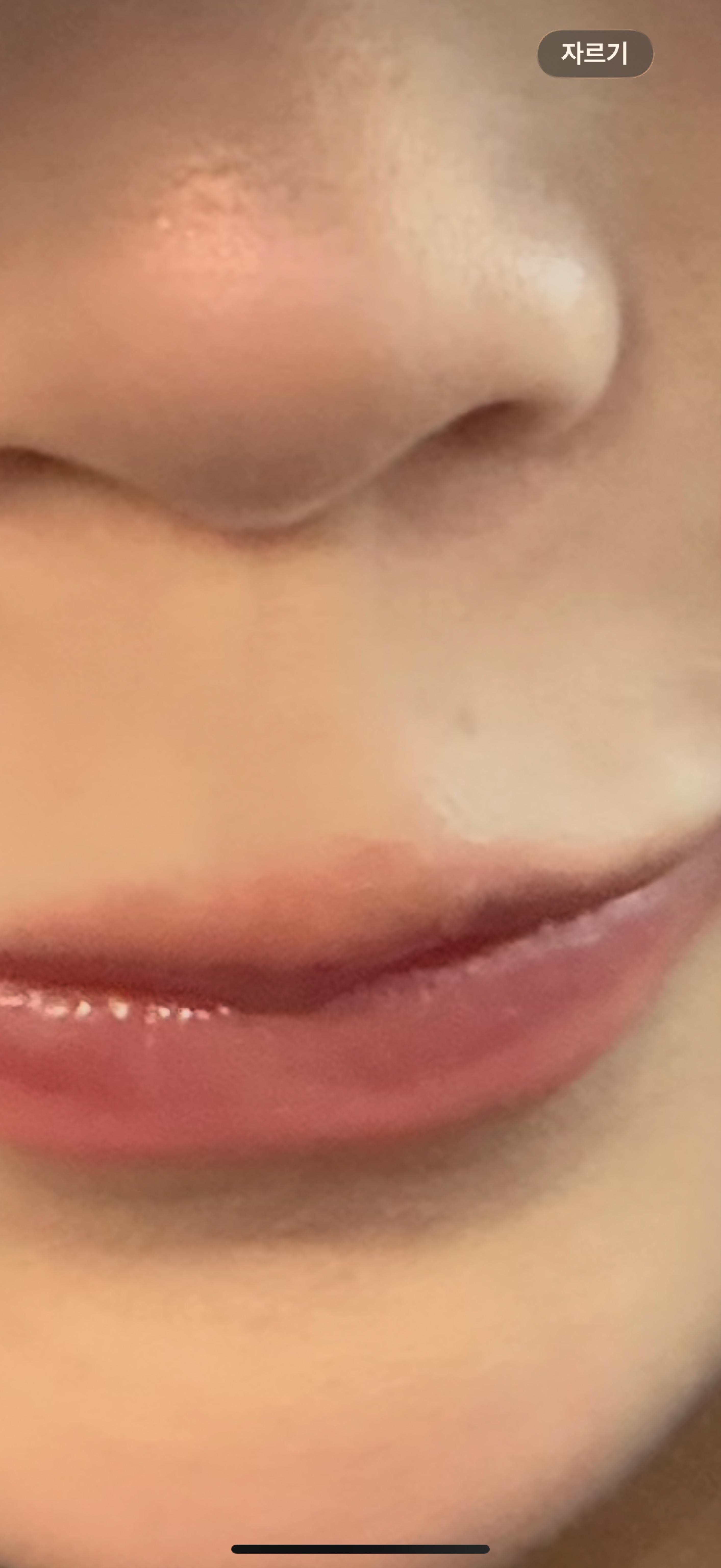 後