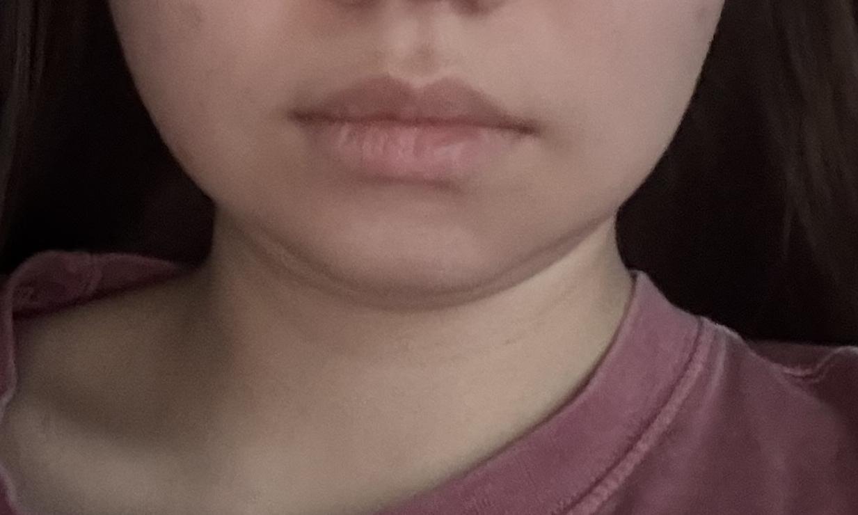 後