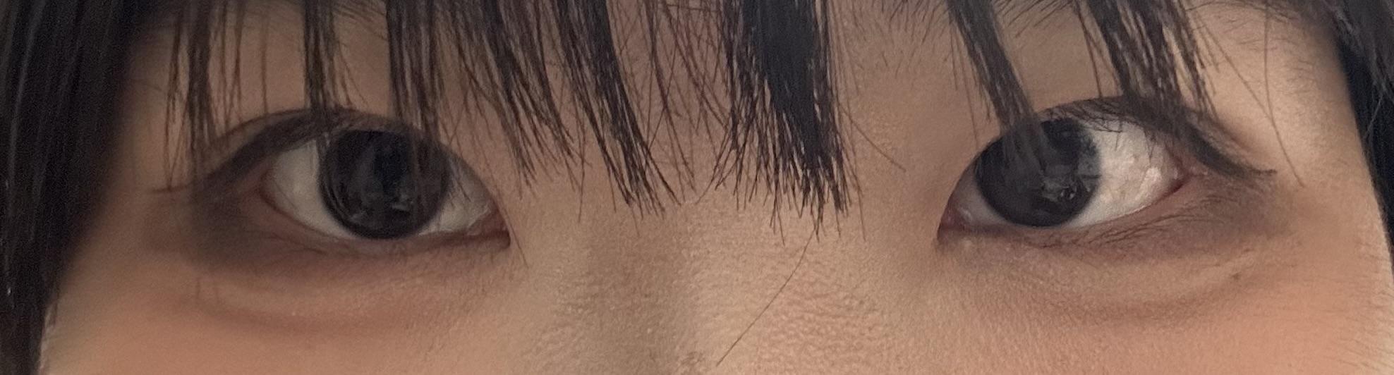 後