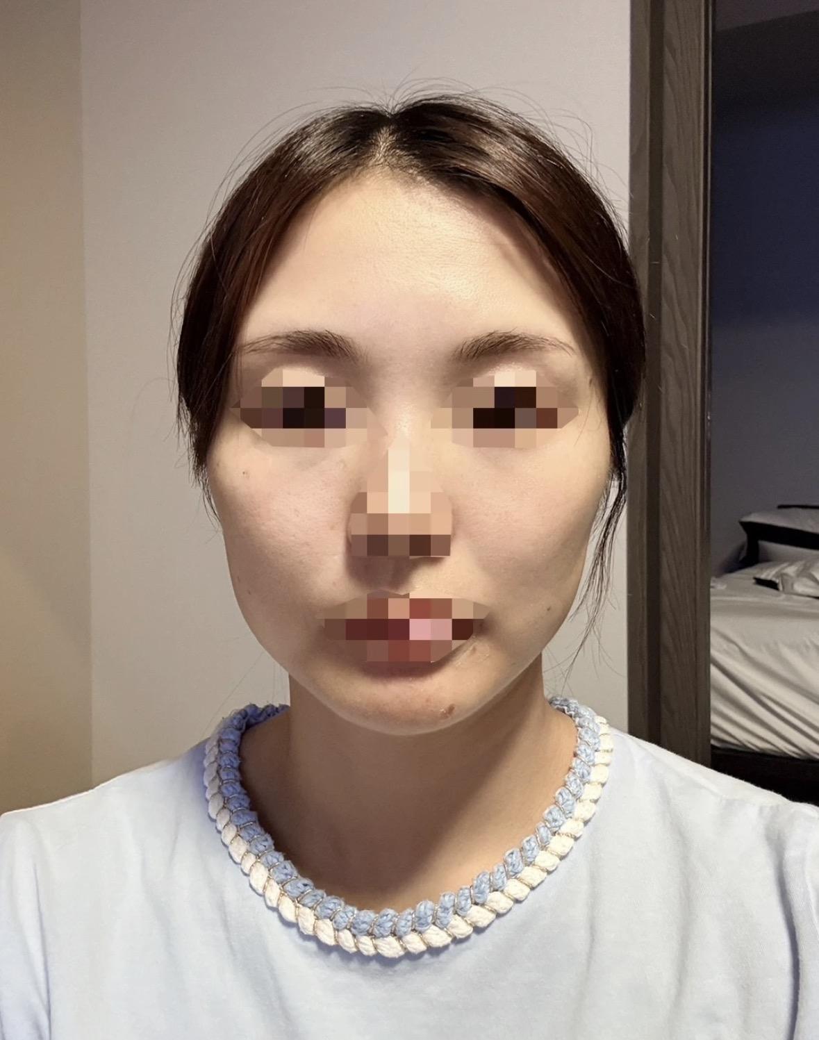 後