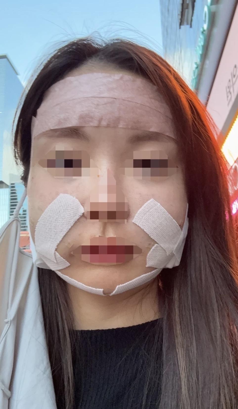 後