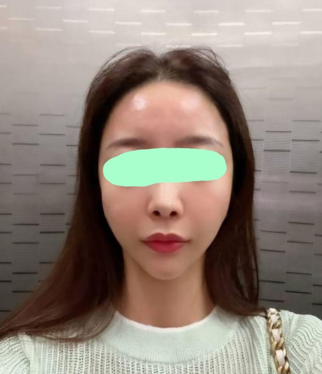 後