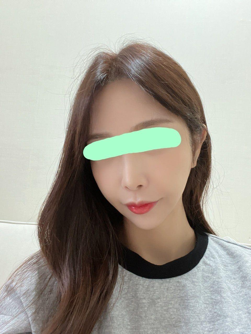 後