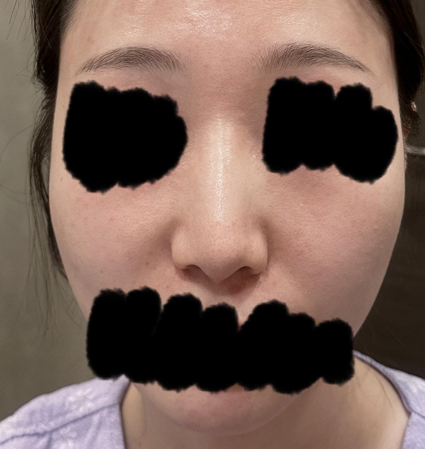前