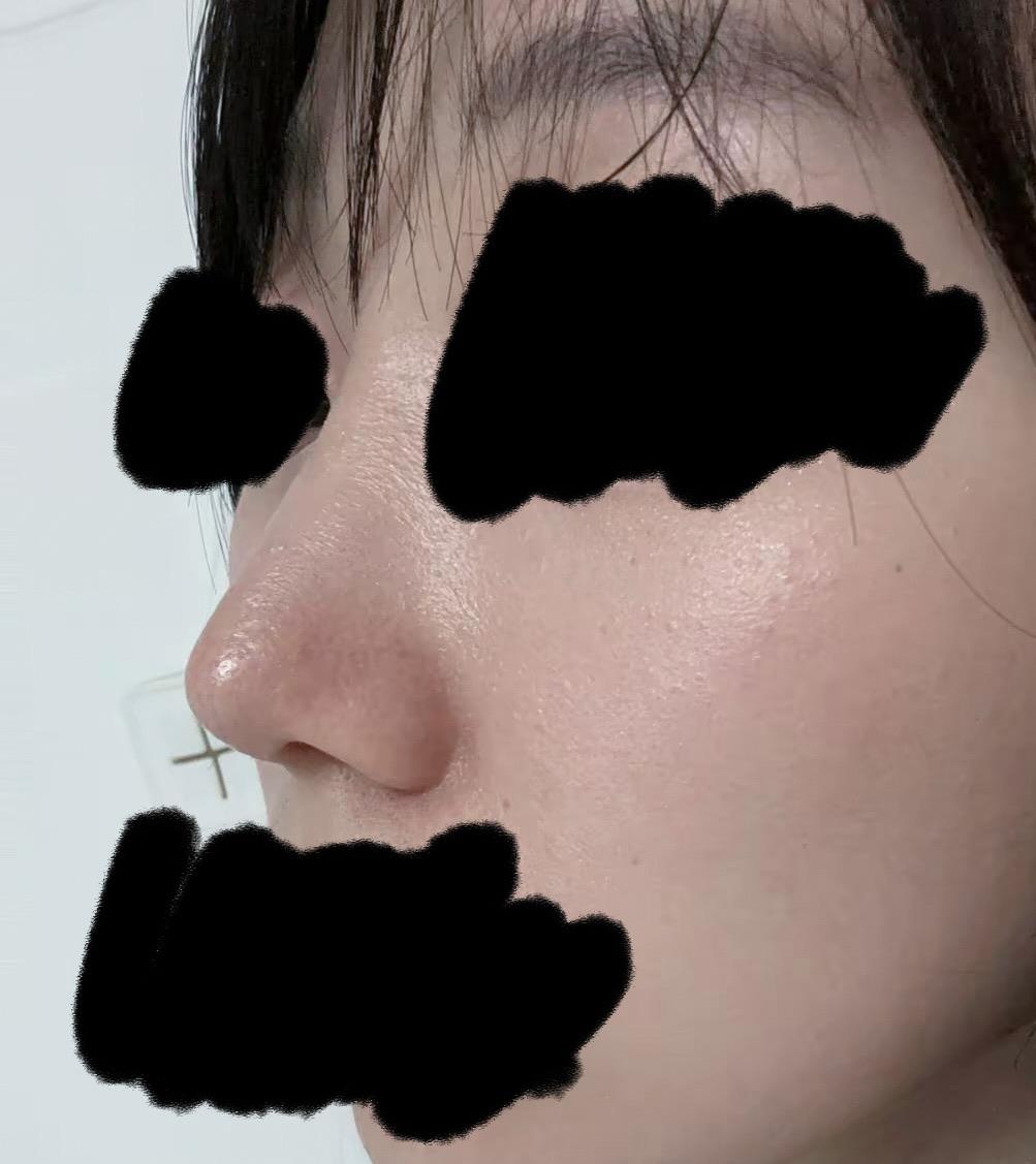 后