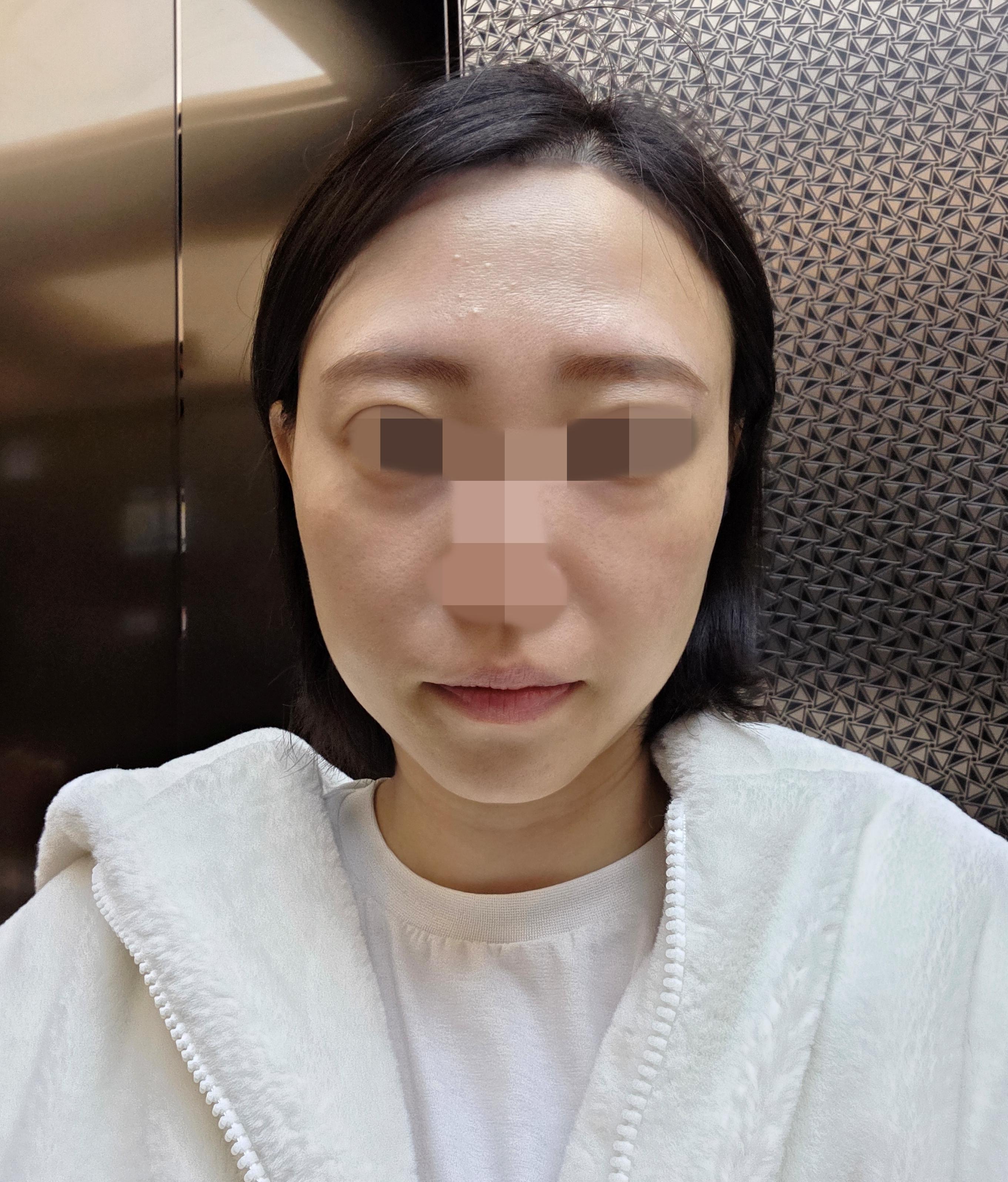 後