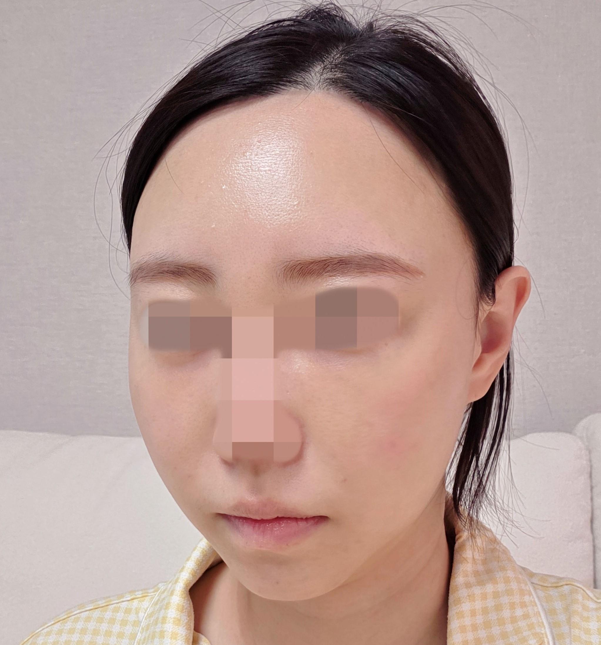 後