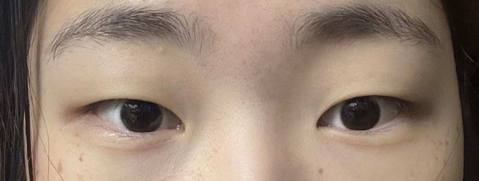 後