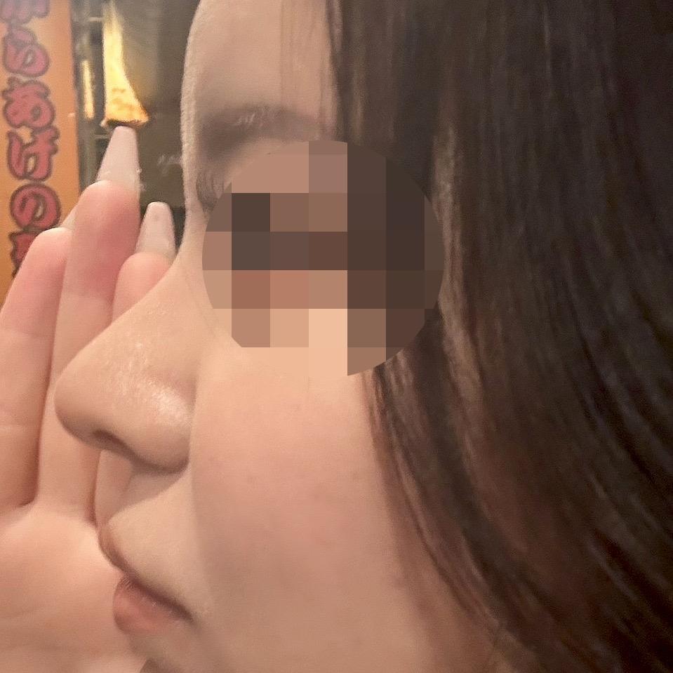 後