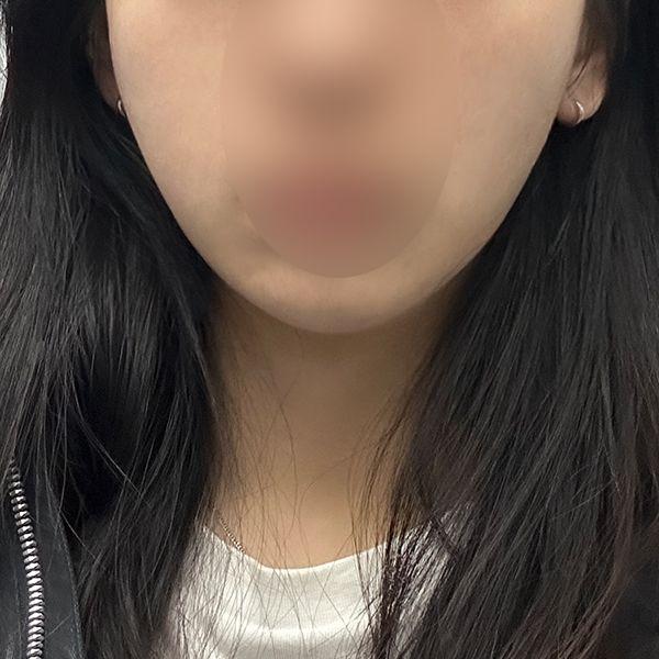 後