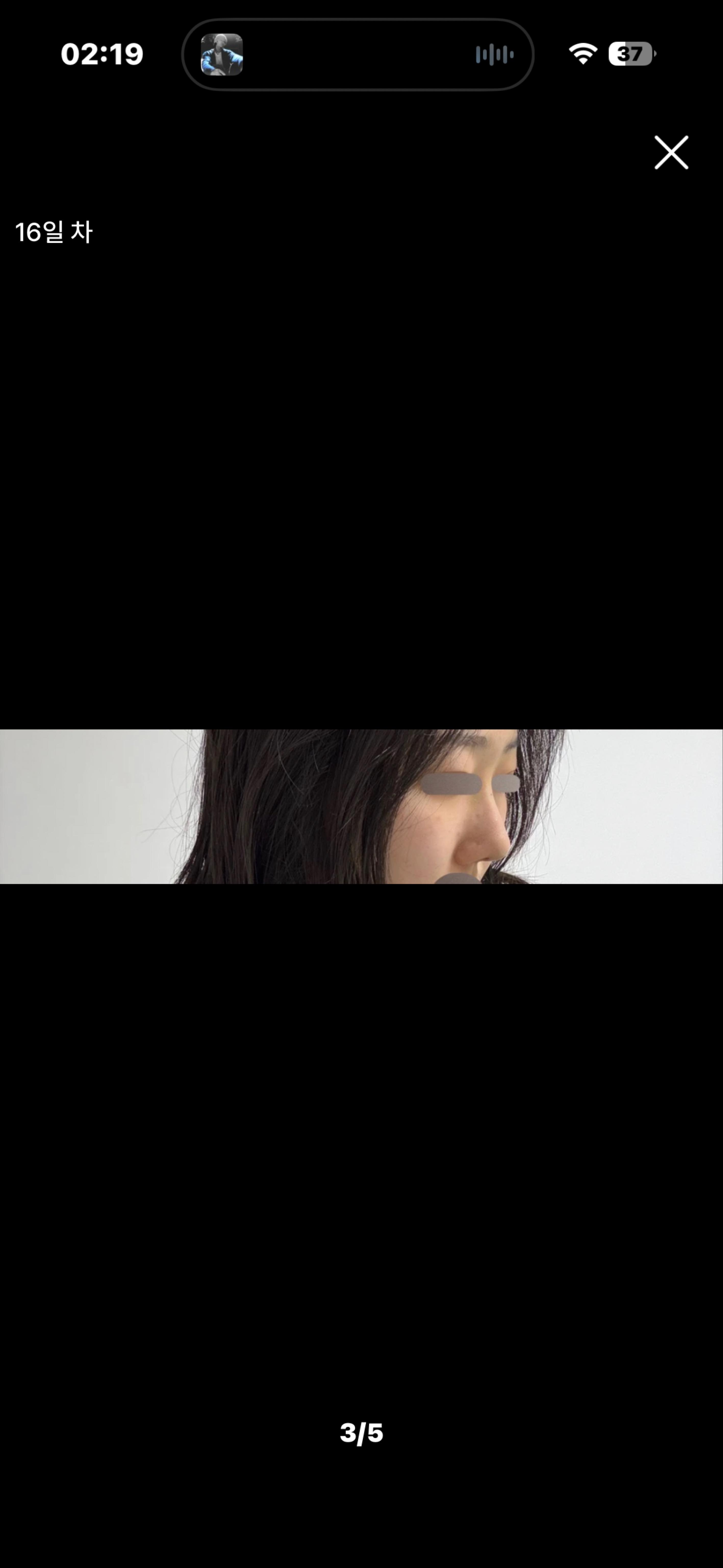 後