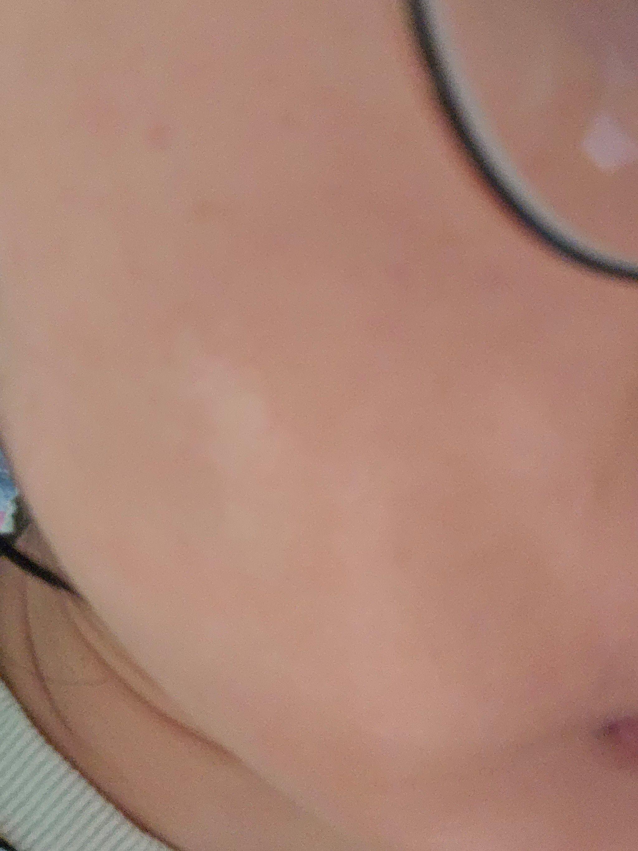 後