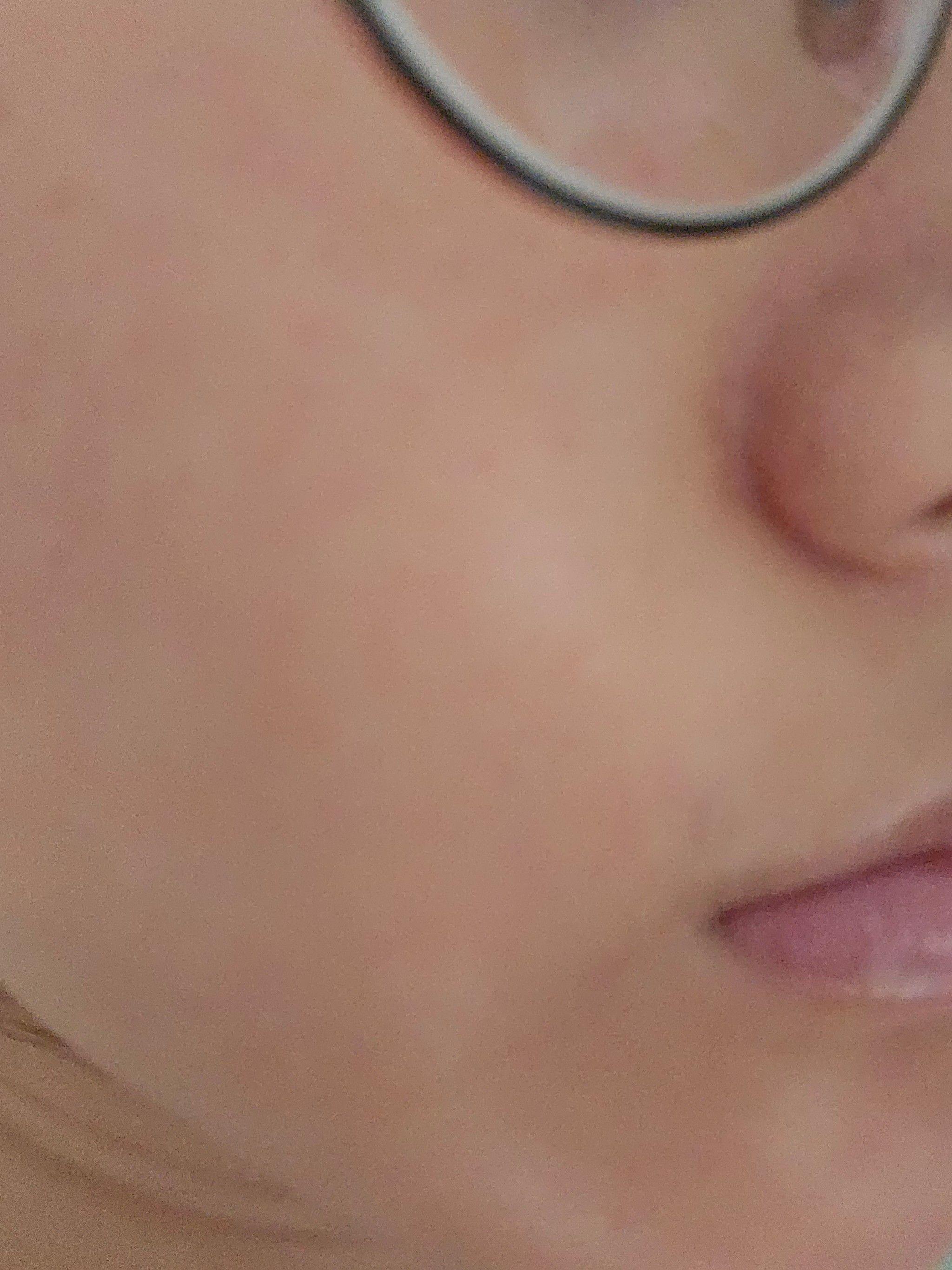 後