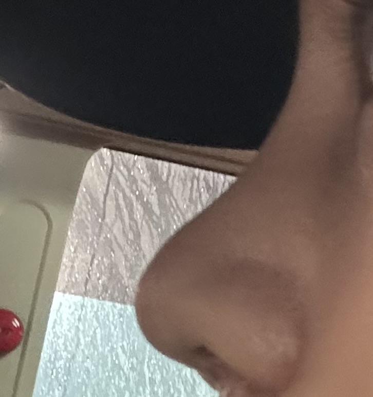 後