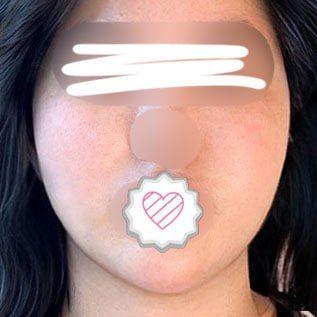后