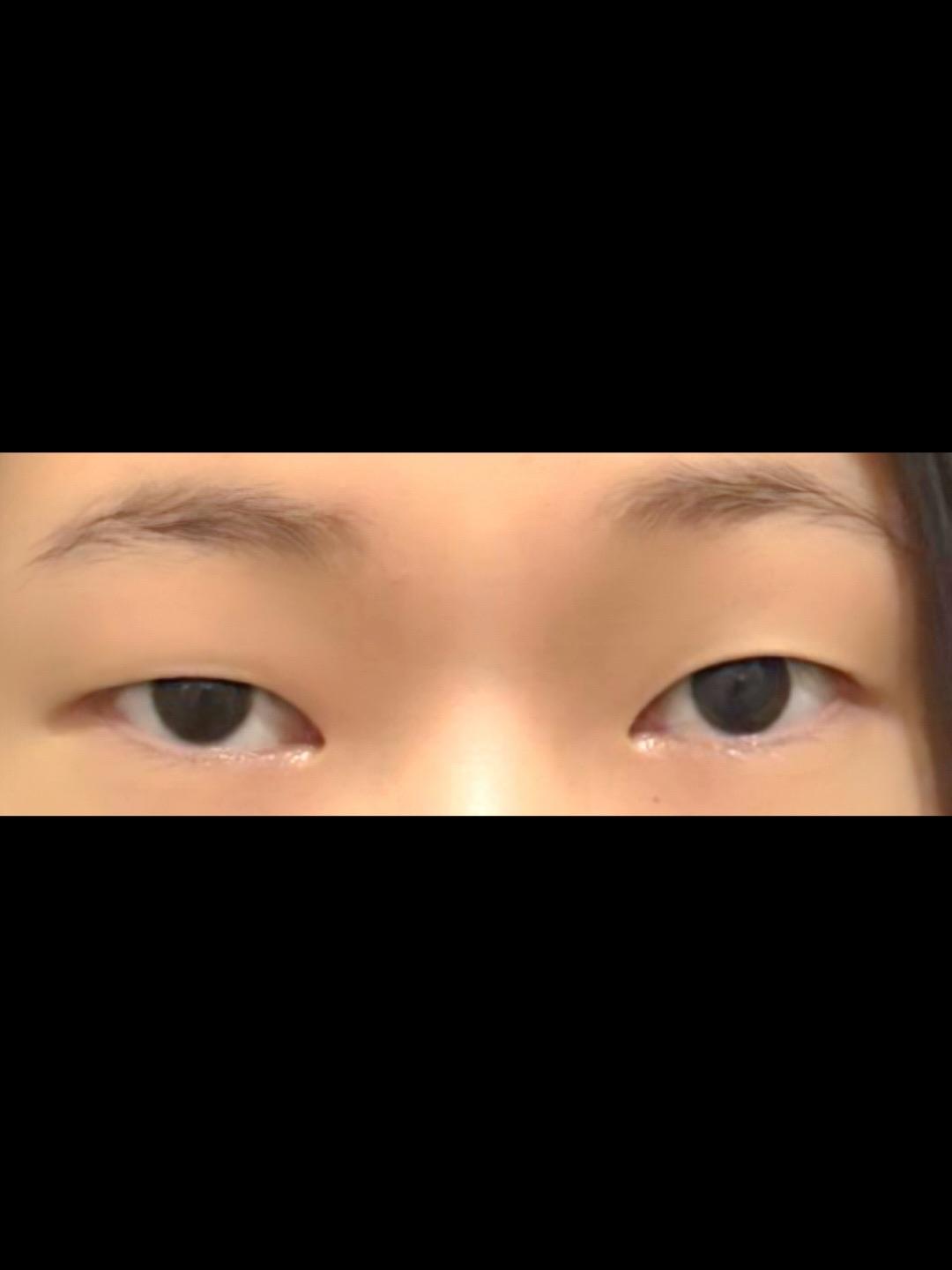 後